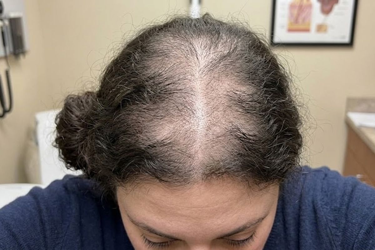 Before treatment